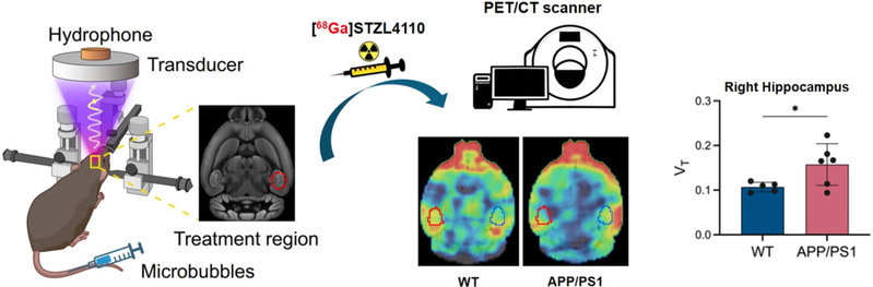聚焦超声助力新型PET显像剂脑内递送，生医工学院合作新成果为阿尔茨海默症早期诊断提供新策略